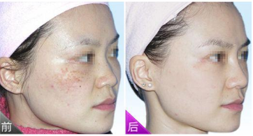 ��������Ŵ���ȸ�߰�����ȫ?