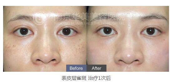 �Ͼ���ô��Ч�����ȸ�ߣ�