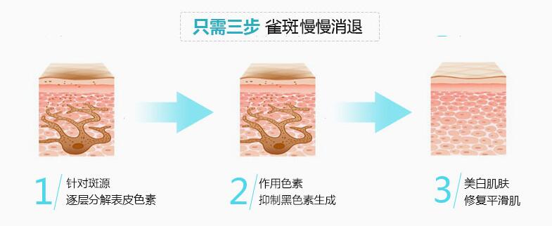 �Ͼ������۷��������ᷴ����