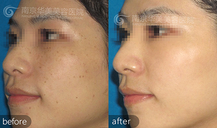 �Ͼ��沿�İߵ�������