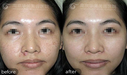 �Ͼ�������߽��ʲ����ױ䱡��